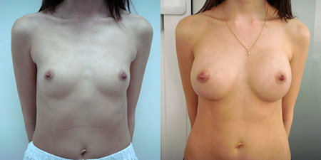 Балкизов Вячеслав Валерьевич. Фото до и после операций