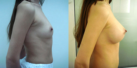 Балкизов Вячеслав Валерьевич. Фото до и после операций5