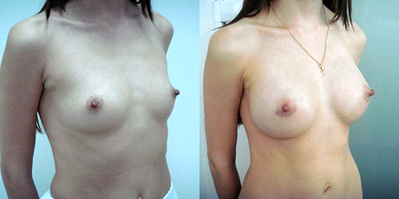 Хирург: Балкизов Вячеслав Валеоьевич. Фото до и после операций