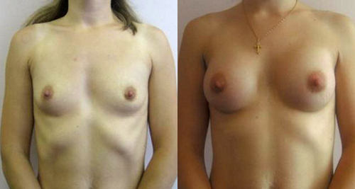 Фархат Фуад Ахмедович. Фото до и после операций-3