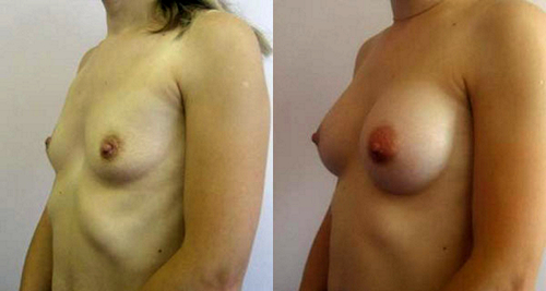 Фархат Фауд Ахмедович. Фото до и после проведения операций