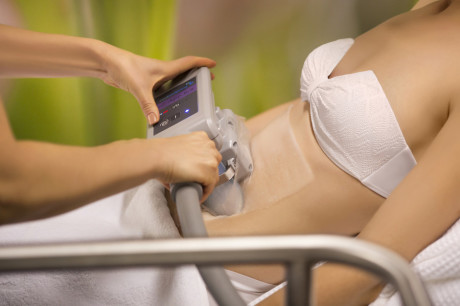 Криолиполиз на аппарате «Zeltiq»