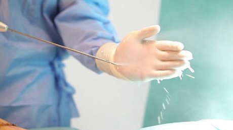 Как выполняется водоструйная липосакция