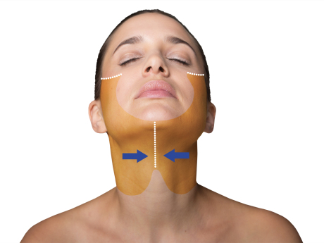 Подтяжка шейной области кожного покрова