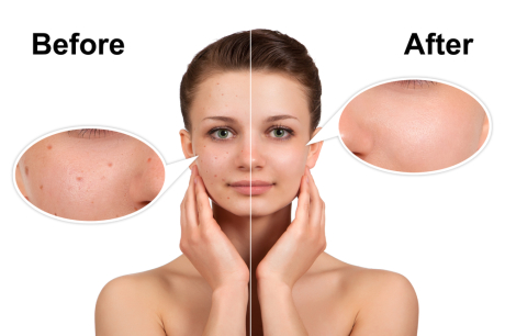 Преимущества метода механической чистки