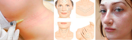 Каким способом можно ликвидировать папулы?