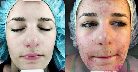 Возможные осложнения