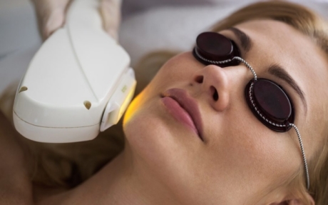 Фотоомоложение лица