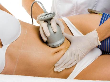 Ультразвуковая липосакция