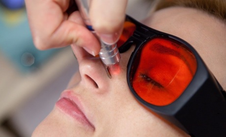 Методы лечения купероза