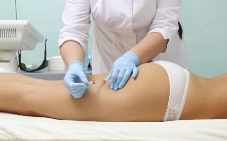 Липолиз и липолитики для борьбы с лишним жиром