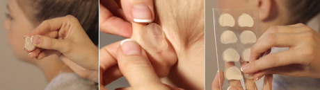 Ушные корректоры: как они работают Ушные корректоры: как они работают