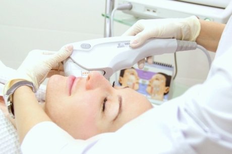 Альтера Систем - лифтинг без операции