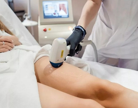 Ультразвуковая эпиляция
