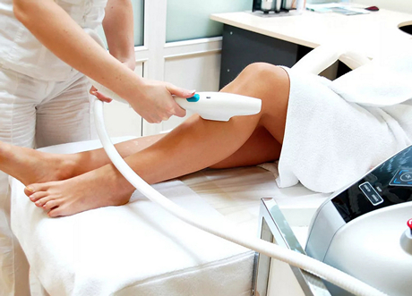 Фотоэпиляция