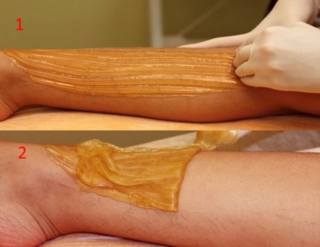 Все о ваксинге