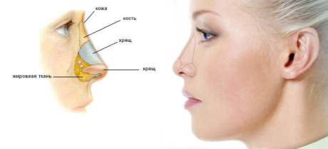 Возможные последствия ринопластики