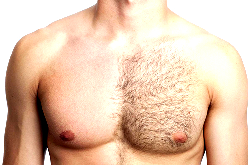 Мужская депиляция