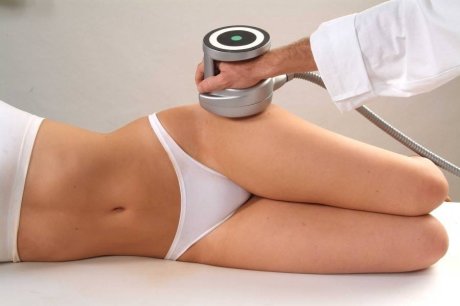 Липосакция без операции