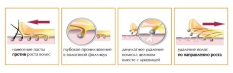 Шугаринг - эпиляция сахаром
