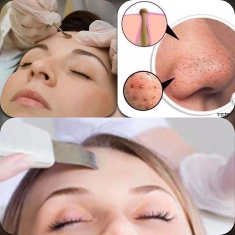 Гальваническая чистка лица