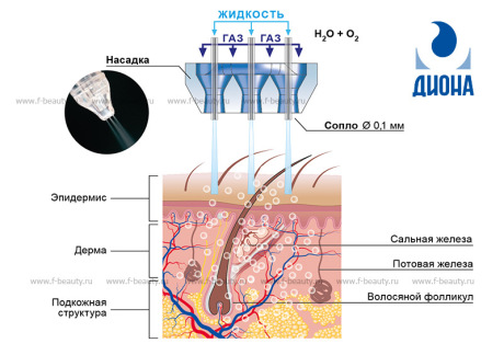 Газожидкостный пилинг и все о нем