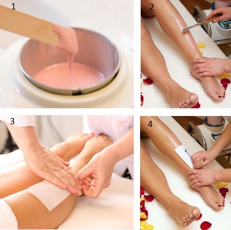 Биоэпиляция