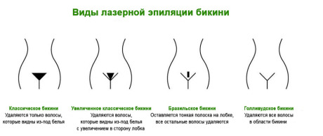 Бразильская эпиляция