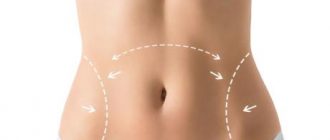 Миниабдоминопластика – минимальное хирургическое вмешательство для эффективной коррекции живота
