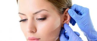 Пластика для мочек ушных раковин