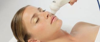 Отзыв о процедуре RF лифтинга