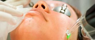 Что несет в себе лазерная шлифовка