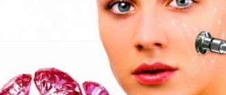 Дермабразия все о ней