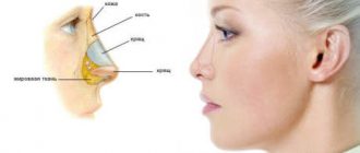 Возможные последствия ринопластики