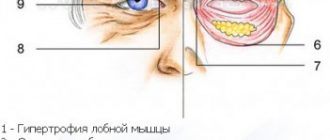 Подтяжка век без операционного вмешательства и с операцией: что лучше