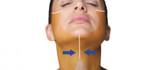 Подтяжка шейной области кожного покрова