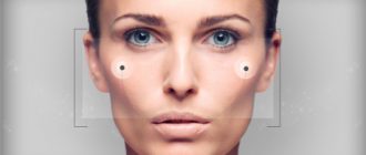 Изменение формы и объема скул: современные методы
