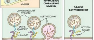 Вреден ли ботокс для нашего организма – принцип действия и последствия уколов молодости