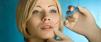 Ботокс губ до и после: стоит ли накачать губы и носогубные складки ботоксом + последствия