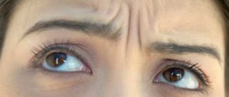 Ботокс – оружие против морщин и депрессии