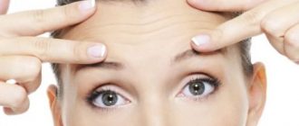 Методы и особенности подтяжки бровей и лба