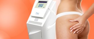 Что такое дермотония