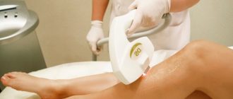 ЭЛОС-эпиляция и все о ней