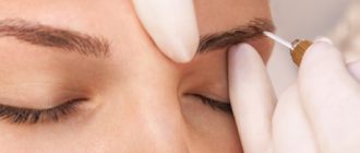 Пересадка бровей