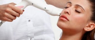 Фракционная мезотерапия лица: цена и отзывы
