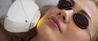 Фотоомоложение лица