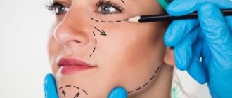 Фейслифтинг – подтяжка кожи лицевой части