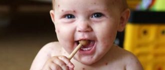 Удаление рубцов и шрамов на лице и теле: виды шрамов и способы их удаления