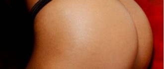 Пластика ягодиц: зачем нужна и сколько стоит глютеопластика + фото