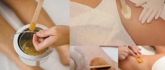 Эпиляция воском